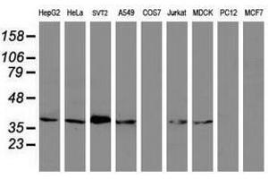 Image no. 3 for anti-Melanoma Antigen Family B, 1 (MAGEB1) antibody (ABIN1499266) (MAGEB1 antibody)