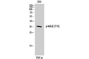 Western Blotting (WB) image for anti-NF-kappa-B inhibitor beta (NFKBIB) (pThr19) antibody (ABIN3180433) (NFKBIB antibody  (pThr19))