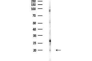 anti-Protein Phosphatase 1, Regulatory (Inhibitor) Subunit 14C (PPP1R14C) (Internal Region) antibody
