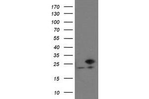 HEK293T cells were transfected with the pCMV6-ENTRY control (Left lane) or pCMV6-ENTRY VBP1 (Right lane) cDNA for 48 hrs and lysed. (VBP1 antibody)