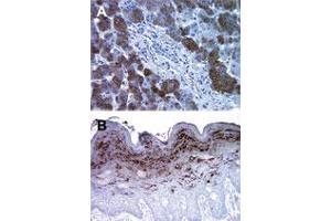 Bax Inhibitor 1 antibody  (C-Term, N-Term)