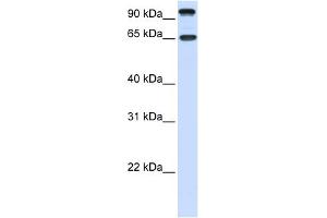 WB Suggested Anti-NTRK3 Antibody Titration:  0. (NTRK3 antibody  (C-Term))