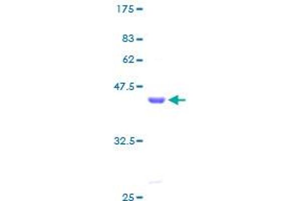 LMO3 Protein (AA 1-145) (GST tag)