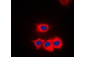 Immunofluorescent analysis of SSBP1 staining in HeLa cells.