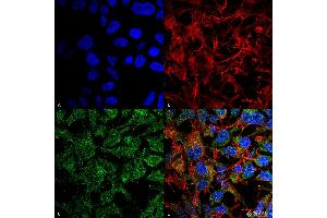 Immunocytochemistry/Immunofluorescence analysis using Rabbit Anti-BDNF Polyclonal Antibody . (BDNF antibody  (N-Term) (Atto 488))