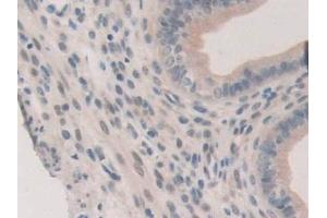 Detection of ERa in Mouse Uterus Tissue using Polyclonal Antibody to Estrogen Receptor Alpha (ERa) (Estrogen Receptor alpha antibody  (AA 233-483))
