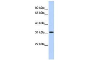 Image no. 1 for anti-3-hydroxyisobutyrate Dehydrogenase (HIBADH) (AA 252-301) antibody (ABIN6741224) (HIBADH antibody  (AA 252-301))
