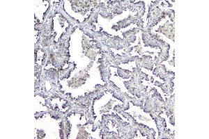 IHC analysis of MPI using anti-MPI antibody (ABIN4886672). (MPI antibody  (AA 2-99))