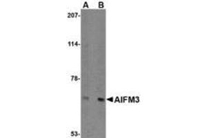 Image no. 1 for anti-Apoptosis-Inducing Factor, Mitochondrion-Associated, 3 (AIFM3) (N-Term) antibody (ABIN1494348) (AIFM3 antibody  (N-Term))