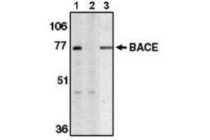 Image no. 1 for anti-Beta-secretase 1 (BACE1) (AA 485-501) antibody (ABIN264995) (BACE1 antibody  (AA 485-501))