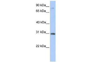 ABHD13 antibody used at 1 ug/ml to detect target protein. (ABHD13 antibody  (C-Term))