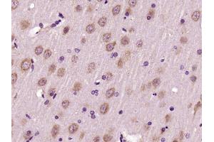 Paraformaldehyde-fixed, paraffin embedded Rat brain Antigen retrieval by boiling in sodium citrate buffer (pH6. (DNM2 antibody  (AA 61-150))