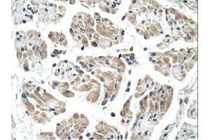 Image no. 1 for anti-Carbohydrate (Keratan Sulfate Gal-6) Sulfotransferase 1 (CHST1) (AA 74-123) antibody (ABIN320945) (CHST1 antibody  (AA 74-123))