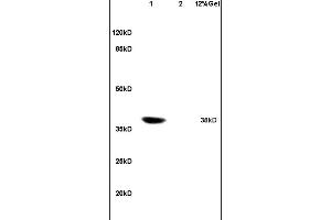 Lane 1: rat heart lysates Lane 2: rat embryo lysates probed with Anti Coxsackie Adenovirus Receptor Polyclonal Antibody, Unconjugated (ABIN739575) at 1:200 in 4C. (GM1123 antibody  (AA 21-120))