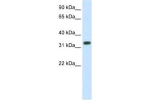 Western Blotting (WB) image for anti-E3 Ubiquitin-Protein Ligase SIAH1 (SIAH1) antibody (ABIN2461673) (SIAH1 antibody)