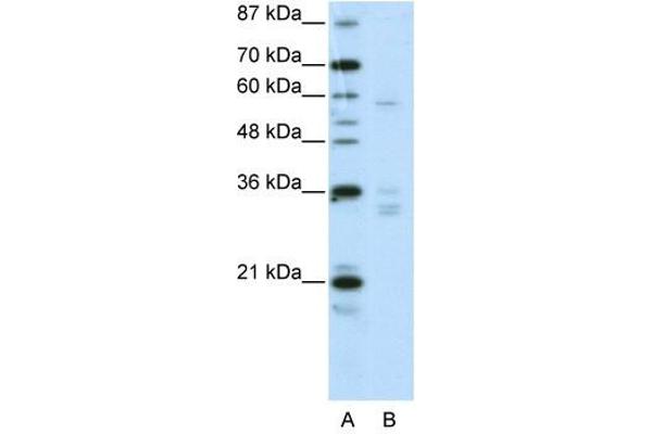 ZNF440 antibody  (N-Term)
