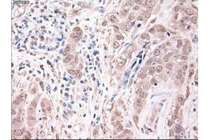 Immunohistochemical staining of paraffin-embedded kidney using anti-Trim33 (ABIN2452534) mouse monoclonal antibody. (TRIM33 antibody  (AA 887-1046))
