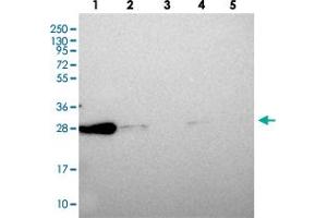 Western blot analysis of CHCHD6 polyclonal antibody . (CHCHD6 antibody)