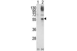 Western blot analysis of GATA2 (arrow) using rabbit polyclonal GATA2 Antibody (Center) . (GATA2 antibody  (Middle Region))