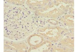 Immunohistochemistry of paraffin-embedded human kidney tissue using ABIN7175891 at dilution of 1:100 (RPGRIP1 antibody  (AA 400-580))