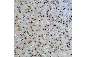 Immunohistochemical analysis of 14-3-3 epsilon staining in rat brain formalin fixed paraffin embedded tissue section. (YWHAE antibody)