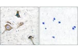 Immunohistochemistry analysis of paraffin-embedded human brain tissue, using MMP-16 Antibody. (MMP16 antibody  (AA 551-600))
