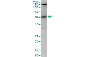 AKT1 monoclonal antibody (M03), clone 2E11. (AKT1 antibody  (AA 1-480))