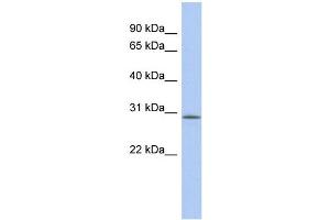 WB Suggested Anti-VSTM2A Antibody Titration: 0.