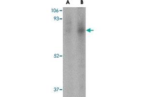 Western blot analysis of FAF1 in Jurkat cell lysate with FAF1 polyclonal antibody  at (A) 1 and (B) 2 ug/mL .