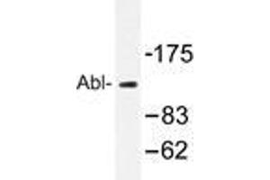 Western blot analysis of Abl antibody in extracts from COS7 cells. (ABL1 antibody)