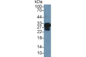 Western Blotting (WB) image for anti-Cardiac Troponin I (TNNI3) (AA 1-211) antibody (ABIN7431863)