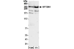 Western Blotting (WB) image for anti-Spectrin Beta, Non-Erythrocytic 1 (SPTBN1) (AA 2100-2150) antibody (ABIN7454694)