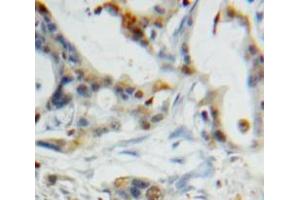 Used in DAB staining on fromalin fixed paraffin-embedded Pancreas tissue (CST6 antibody  (AA 29-149))