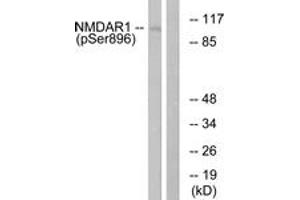 Western blot analysis of extracts from K562 cells treated with PMA 125ng/ml 30', using NMDAR1 (Phospho-Ser896) Antibody. (GRIN1/NMDAR1 antibody  (pSer897))