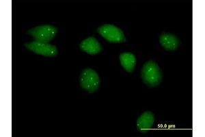 Immunofluorescence of purified MaxPab antibody to NSMCE2 on HeLa cell. (NSMCE2 antibody  (AA 1-247))