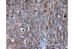 Immunohistochemical staining of paraffin-embedded liver tissue using anti-CD36 mouse monoclonal antibody.