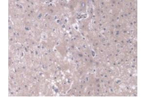IHC-P analysis of Human Liver Tissue, with DAB staining. (TOM70 antibody  (AA 333-608))