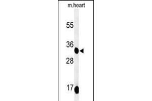 Western blot analysis of COQ9 Antibody (Center) (ABIN651084 and ABIN2840064) in mouse heart tissue lysates (35 μg/lane). (COQ9 antibody  (AA 156-184))