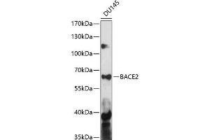 Western blot analysis of extracts of DU145 cells, using B antibody (ABIN7265880) at 1:1000 dilution. (BACE2 antibody  (AA 240-470))