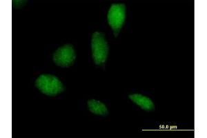 Immunofluorescence of purified MaxPab antibody to RECQL5 on HeLa cell. (RECQL5 antibody  (AA 1-435))