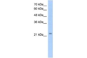 EMP2 antibody used at 1. (EMP2 antibody  (Middle Region))