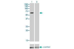 Western blot analysis of IRAK3 over-expressed 293 cell line, cotransfected with IRAK3 Validated Chimera RNAi (Lane 2) or non-transfected control (Lane 1). (IRAK3 antibody  (AA 497-596))