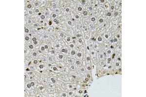 Immunohistochemistry of paraffin-embedded mouse liver using PNKP antibody (ABIN2564598) at dilution of 1:100 (40x lens). (PNKP antibody)