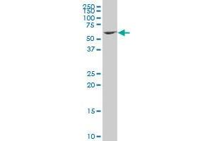 ZNF37A polyclonal antibody (A01), Lot # 051005JC01 Western Blot analysis of ZNF37A expression in MES-SA/Dx5 . (ZNF37A antibody  (AA 121-230))
