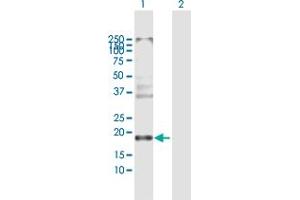 Western Blot analysis of CLDN8 expression in transfected 293T cell line by CLDN8 MaxPab polyclonal antibody. (CLDN8 antibody  (AA 1-225))