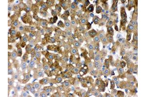 Immunohistochemistry (Paraffin-embedded Sections) (IHC (p)) image for anti-Sulfotransferase Family, Cytosolic, 2A, Dehydroepiandrosterone (DHEA)-Preferring, Member 1 (SULT2A1) (AA 253-285), (C-Term) antibody (ABIN3043941)