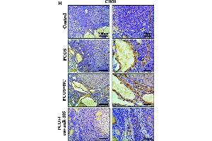 MiR-185 inhibited the angiogenic effect in the ovaries of PCOS rats. (CD31 antibody)