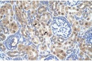 Immunohistochemical staining (Formalin-fixed paraffin-embedded sections) of human kidney with ARMCX6 polyclonal antibody  at 4-8 ug/mL working concentration. (ARMCX6 antibody  (N-Term))