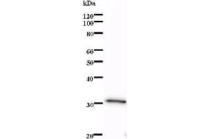 Western Blotting (WB) image for anti-LIM Domain Only 1 (Rhombotin 1) (LMO1) antibody (ABIN932474) (LMO1 antibody)
