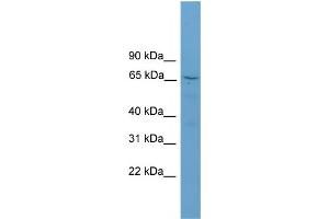 WB Suggested Anti-SCG2 Antibody Titration:  0.